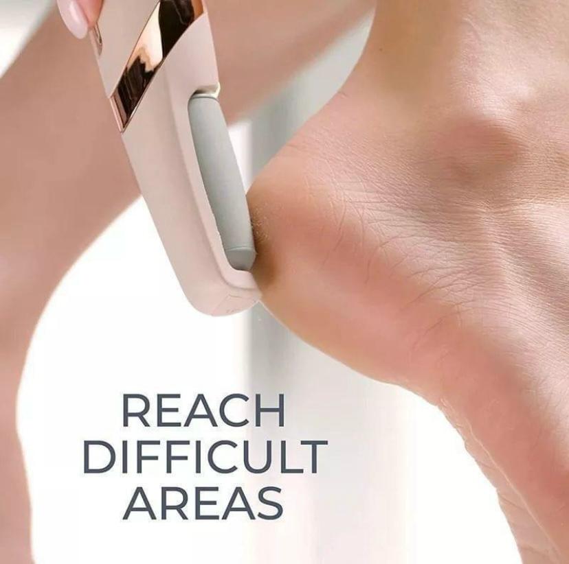 Electric Foot File Callus Remover