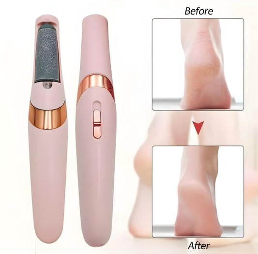 Electric Foot File Callus Remover